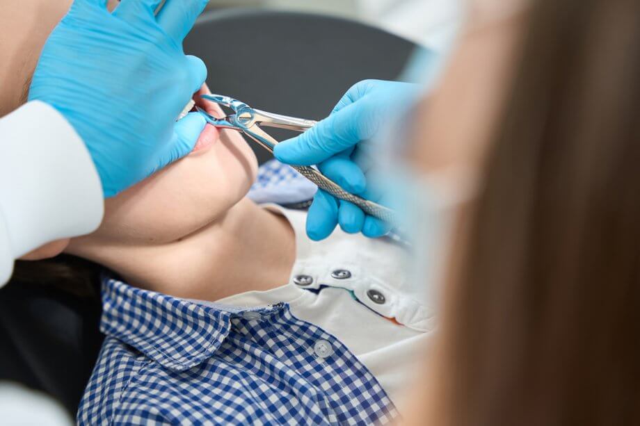How to Prepare for a Surgical Tooth Extraction: A Patient's Guide
