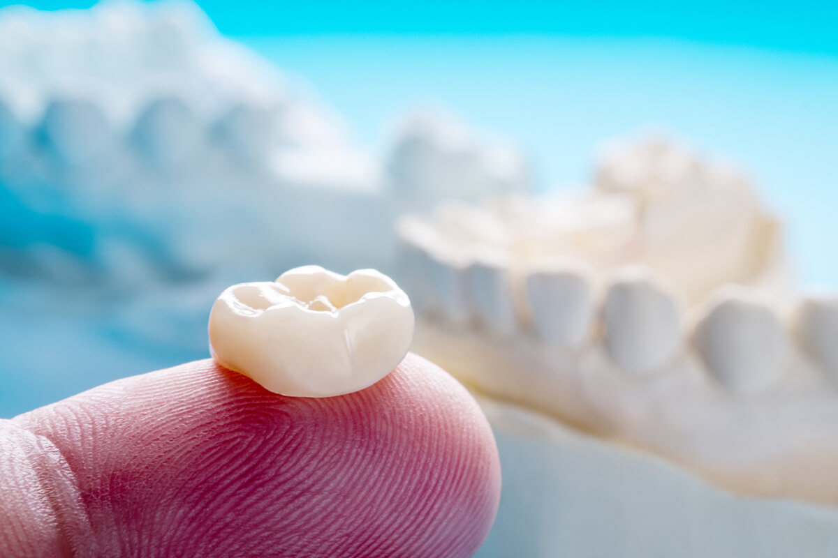 What Are the Different Types of Dental Crowns? Kensington, MD